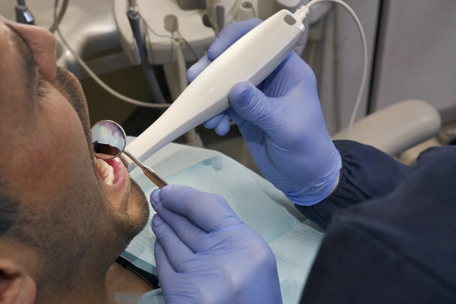Dental clinician documents a small non-graphic chipped front tooth with an unbranded intraoral scanner and dental mirror